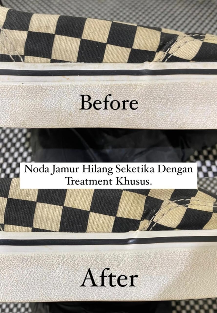 Before dan After
